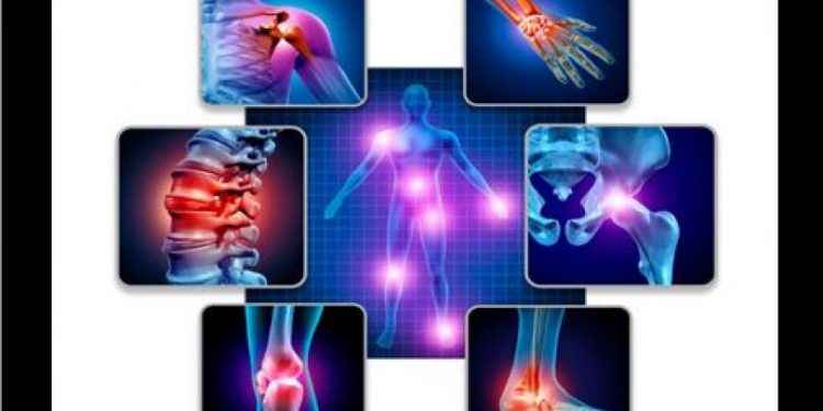 Viscosuplementación, la solución para tratar efectivamente la Osteoartritis en todas sus fases