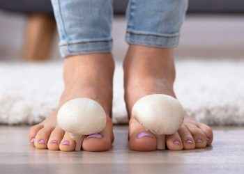 Hongos en las uñas