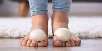 Hongos en las uñas