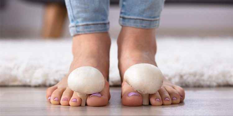 Hongos en las uñas