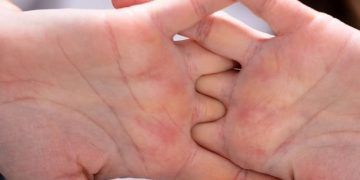 Crujirse los dedos, ¿es realmente malo?