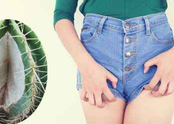 ¿Por qué salen llagas o úlceras en la vulva? 9 causas que no son herpes ni VPH