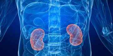 Cáncer de riñón
