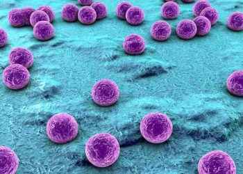 Celulitis infecciosa