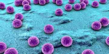 Celulitis infecciosa