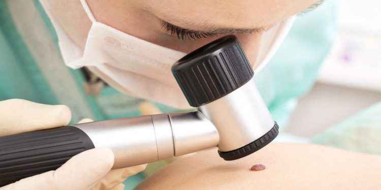 Cuál es el mejor tratamiento del cáncer de piel