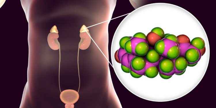 Síndrome de Cushing: ¿qué es y por qué aparece?