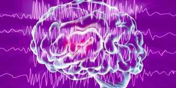 Epilepsia
