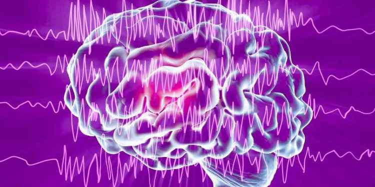 Epilepsia