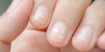 Manchas blancas en las uñas, ¿a qué se deben?