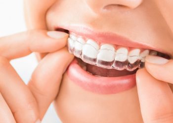 Ortodoncia invisible: todo lo que necesitas saber