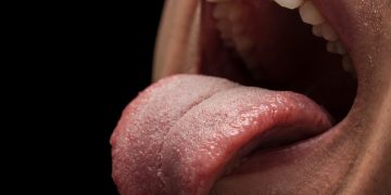 ¿Tienes siempre la boca seca? Puedes sufrir xerostomía