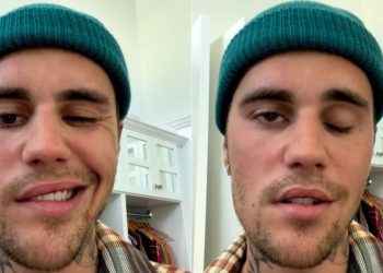 Justin Bieber confesó que sufre de parálisis en la mitad del rostro por un virus: “Es muy grave”