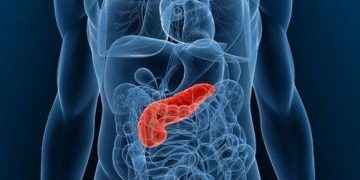 Cáncer de páncreas: síntomas de alerta