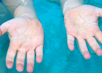 ¿Por qué se arrugan los dedos con el agua?