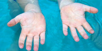 ¿Por qué se arrugan los dedos con el agua?