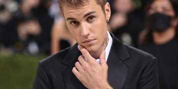 Así quedó Justin Bieber tras sufrir una parálisis facial