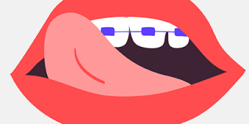 Fetichismo o sentir placer por cosas extrañas ¿es normal?
