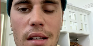 Justin Bieber vuelve a sonreír tras la parálisis