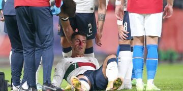 Arquero da trompón a Cristiano Ronald y preocupa a todos