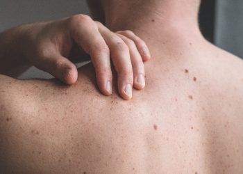10 conclusiones sobre el cáncer de piel