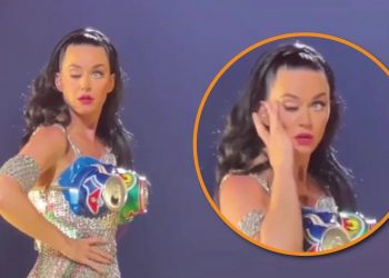 A Katy Perry se le cayó uno de sus párpados y generó preocupación entre sus fans