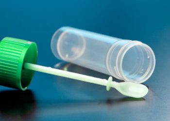 Análisis de heces: ¿cuándo es necesario?