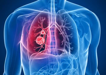 Cáncer de pulmón: cómo detectarlo a tiempo