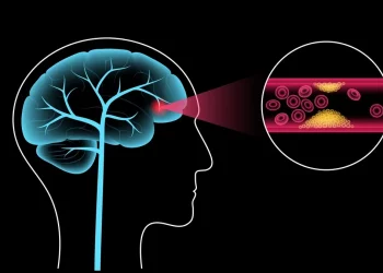 Los tres síntomas clave que avisan de un posible ictus