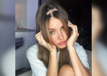 Modelo Aleska Génesis, ex de Nicky Jam, revela su lucha con la alopecia
