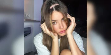 Modelo Aleska Génesis, ex de Nicky Jam, revela su lucha con la alopecia