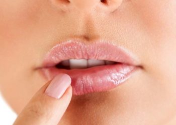 Herpes labial