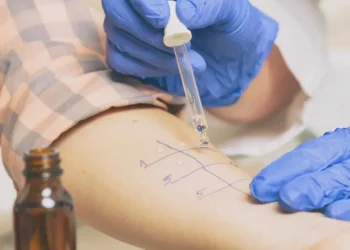 Cómo saber si tengo una alergia rara
