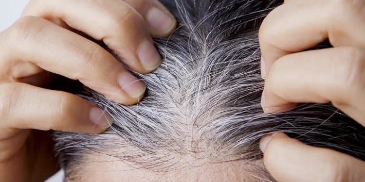 ¿Por qué nos salen canas y cómo podemos prevenirlas?