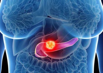 Avances en cáncer de páncreas: investigación para tratarlo antes y mejor