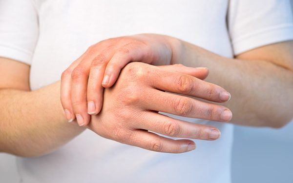 La importancia de detectar a tiempo el lupus o la esclerodermia