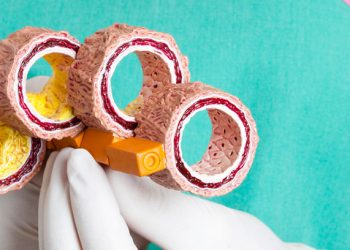 Cómo prevenir la EVA o aterosclerosis y evitar ictus e infartos