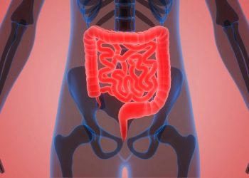 El cáncer de colon está en aumento en personas jóvenes: 5 claves para prevenirlo