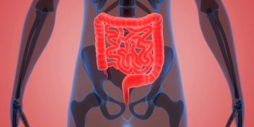 El cáncer de colon está en aumento en personas jóvenes: 5 claves para prevenirlo
