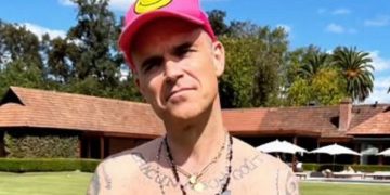 La transformación de Robbie Williams que impresionó en redes sociales