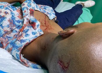Limpiavidrios agrede reportero gráfico en el Distrito Nacional