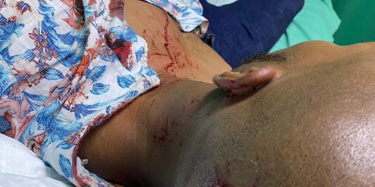 Limpiavidrios agrede reportero gráfico en el Distrito Nacional