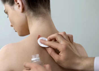 Qué debes hacer (y qué no) para curar una herida