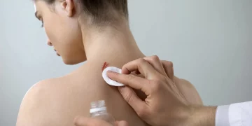 Qué debes hacer (y qué no) para curar una herida