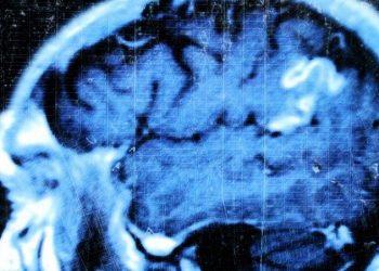 ¿Qué ocurre en el cerebro de una persona con depresión?