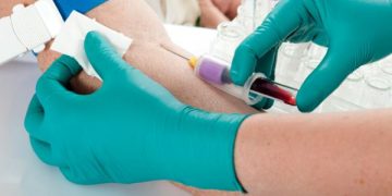 ¿Se puede beber agua antes de un análisis de sangre?