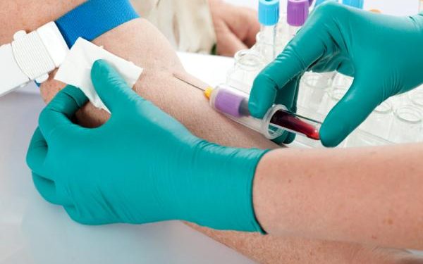 ¿Se puede beber agua antes de un análisis de sangre?