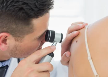 Decálogo para prevenir el melanoma maligno