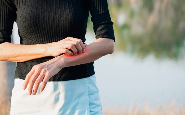 ¿Cómo se relacionan el picor y el dolor?