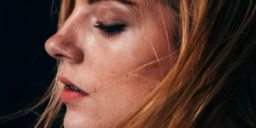 Qué es la ‘skin purge’ y qué hacer si te ocurre